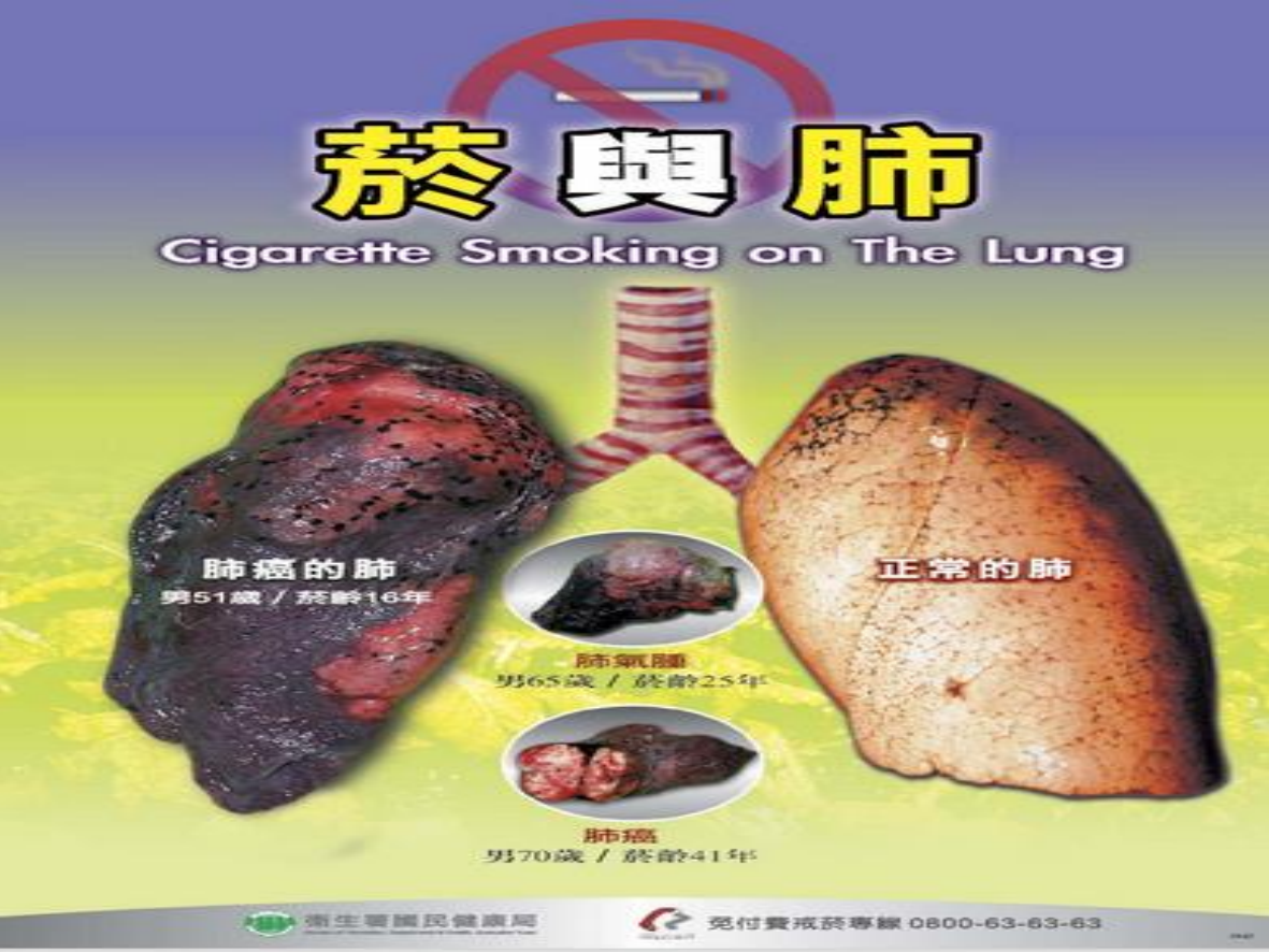 菸害衛教宣導圖片