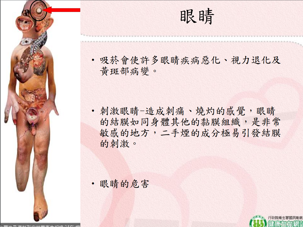 菸害衛教宣導圖片