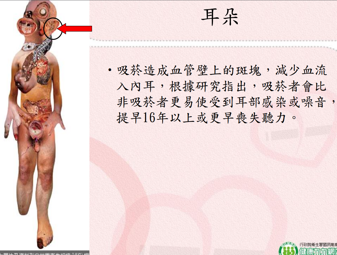 菸害衛教宣導圖片