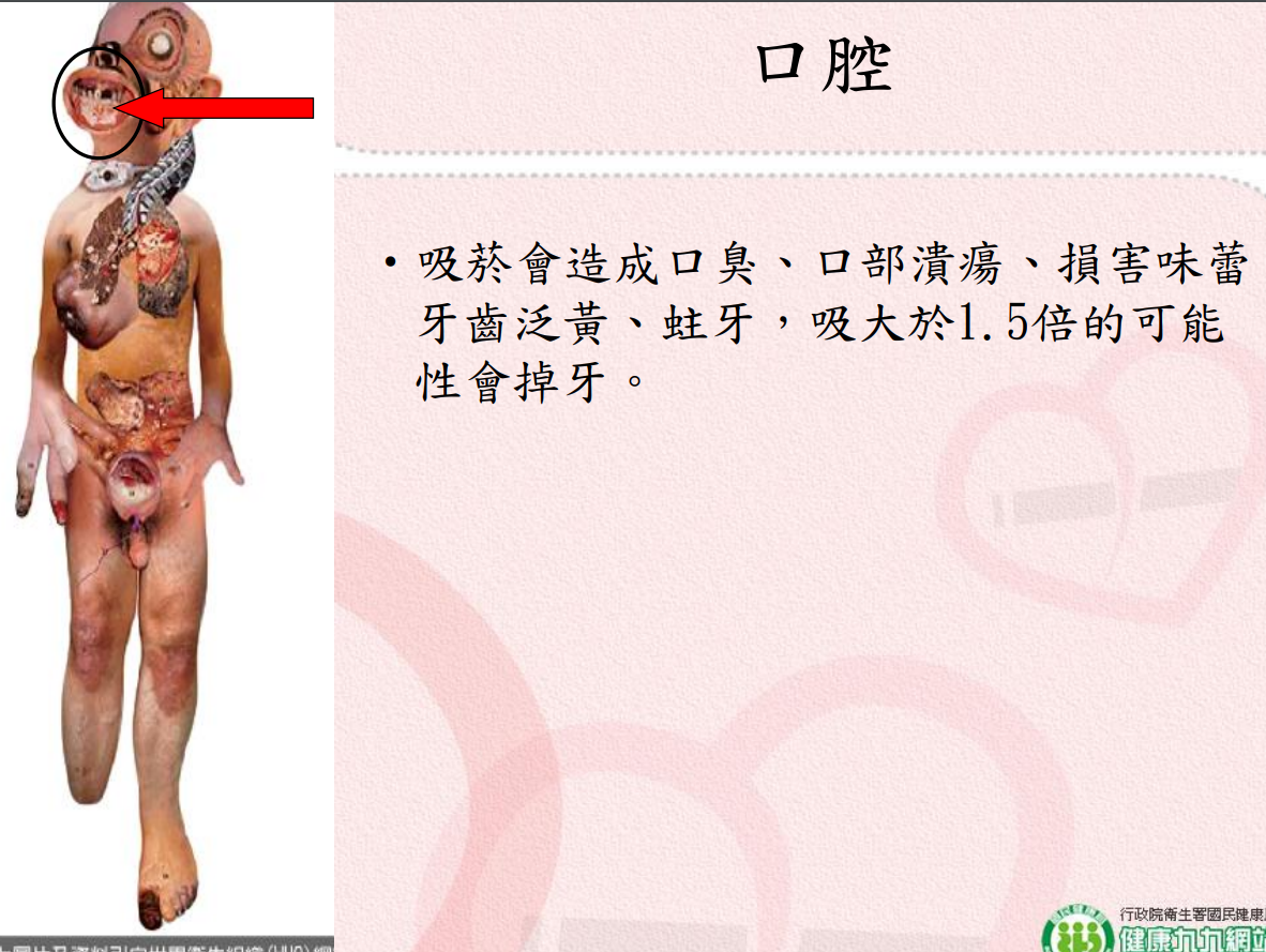 菸害衛教宣導圖片