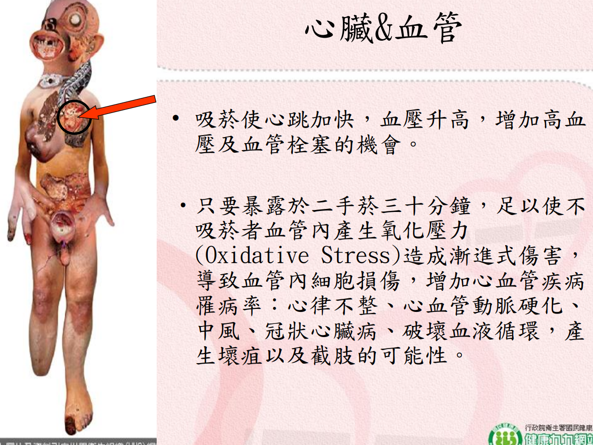 菸害衛教宣導圖片