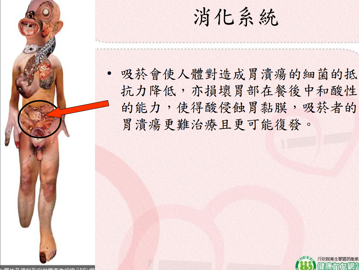 菸害衛教宣導圖片