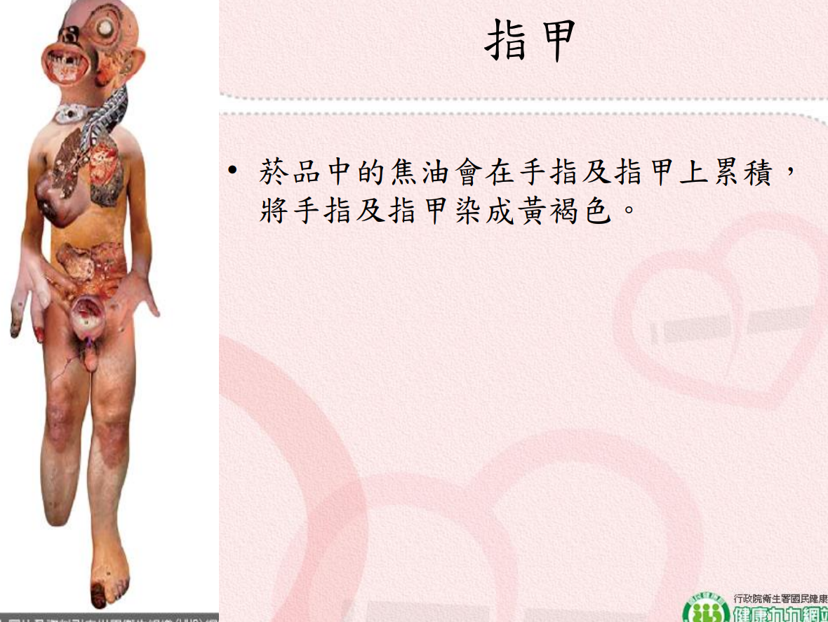 菸害衛教宣導圖片