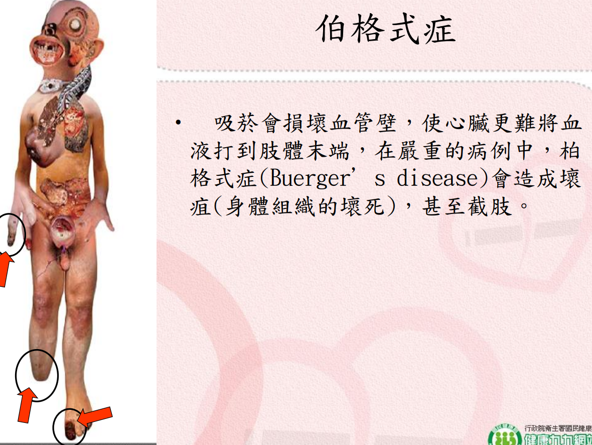 菸害衛教宣導圖片